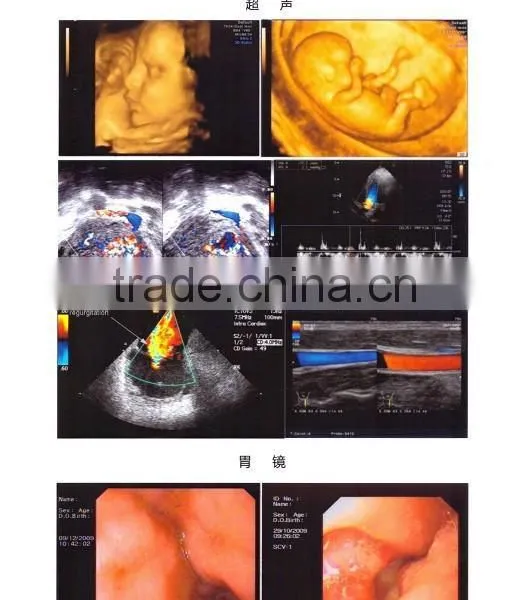 X-ray Laser Medical Films