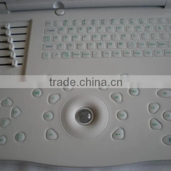 CE Approved Portable Ultrasound Scanner With 3.5Mhz Multi-frequency Convex Probe RUS-9000E photo-2