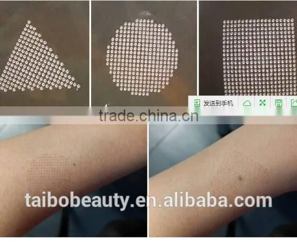 2016 High Power Co2 Fractional rf Tube Laser for Scar Removal photo-5