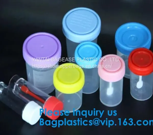 Disposable Urine Specimen Cup/Urine Sample Containers/Urine Collection Cup,Sterile Disposable Hospital Sample 60ml 100
