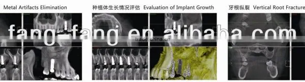 Digital 3D Intra-oral Imaging X-ray Machine