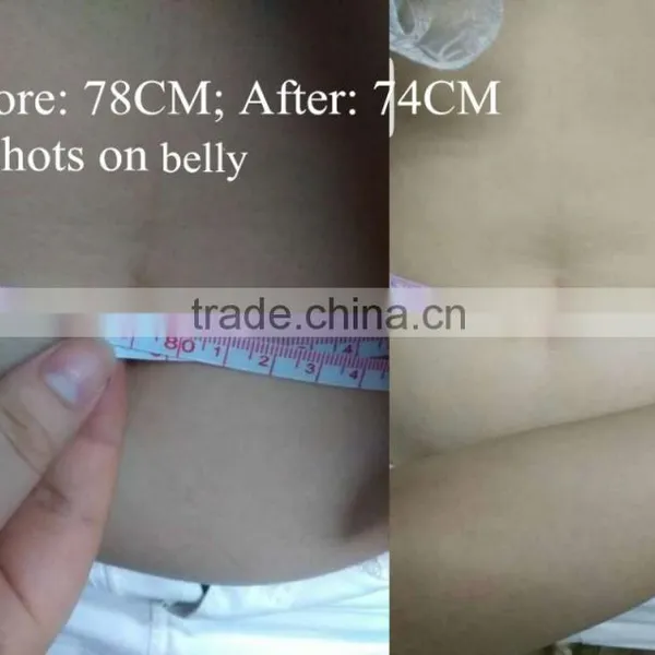 Cryolipolysis Cold Body Scuplting Machine for Spa / Cryolipolysis Machine Price photo-2