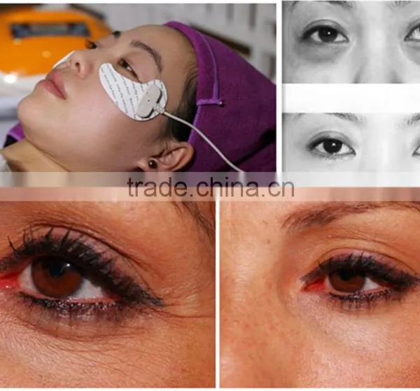 Removing Eye Bags Improve Eye Skin Tighting RF Machines photo-3