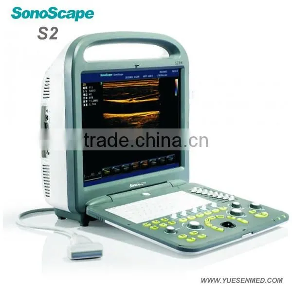 Color Ultrasound Scanner Sonoscape Veterinary Ultrasound photo-4