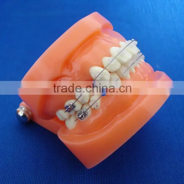 Dental Orthodontic Implant Study Plastic Dental Model of Teeth photo-2