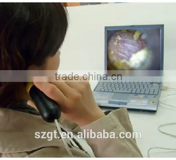 Eardrum Scope Camera photo-3