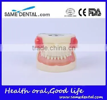Abscess and Tooth Preparation Model School Teaching Demonstration photo-2
