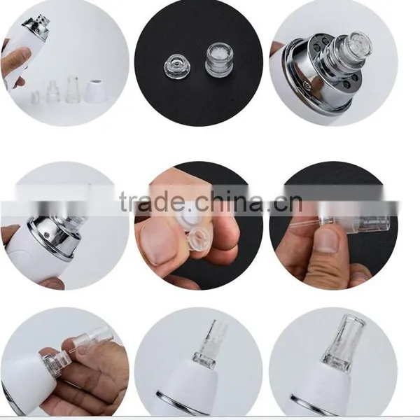 Portable Electronic Blackhead Remover, Facial Blackhead Remover Machine photo-5