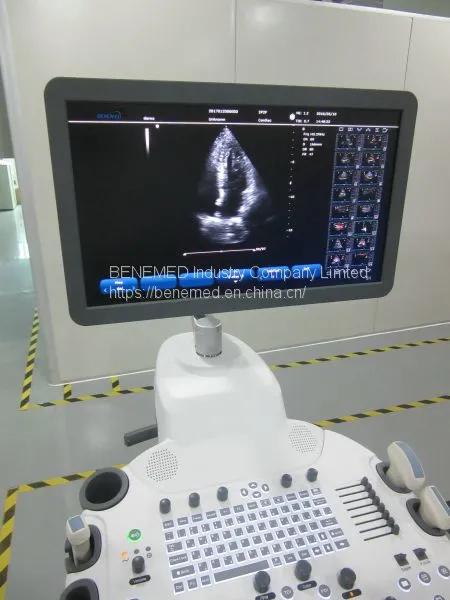 Trolly 2D Echocardiography Color Doppler Ultrasound Scanner Diagnosis Equipment photo-2