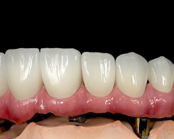 China Dental Laboratory - China Digital Dental Lab China Dental Lab Looks for Cooperation photo-3