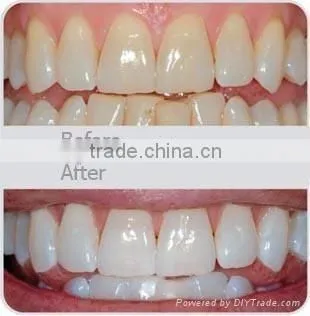AYJ-J003B(CE) China Hot Selling Smart Clinic Dental Teeth Whitening Machine photo-6