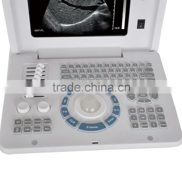 Ultrasound Equipments & Laptop Ultrasonic Machine 3018 photo-2
