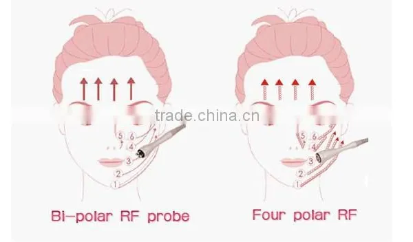 Lift rf Skin Forming Tightening Face Beauty Machine Portable photo-4