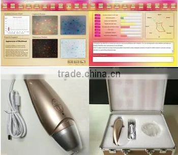 AYJ-J016 Skin Ance Blackhead Wrinkle Microscope photo-4