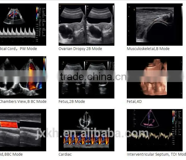 CE ISO Approved Medical 15 Inch LCD Monitor 3D 4D Trolley Color Doppler Ultrasound Scanner photo-5