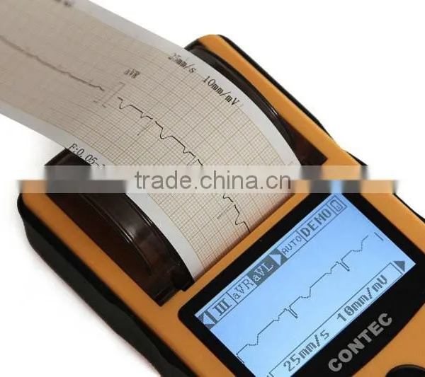 CE&ISO Price Single Channel Palm Handheld Human Use Electrocardiograph ECG Machine EKG Machine Price With Software and Printer photo-4