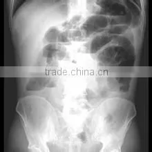 Konida Automatic Fuji Dry Film Laser Medical Hot Sex X-ray Film photo-2