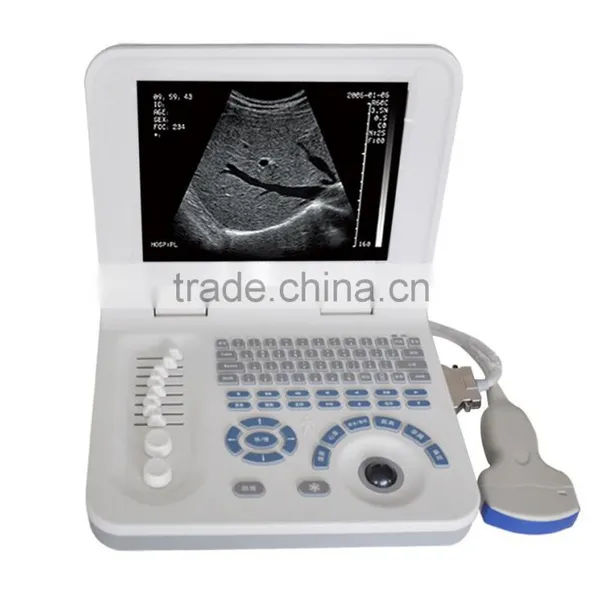 Ultrasound Equipments & Laptop Ultrasonic Machine 3018 photo-4