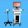 Supply Digital Colposcope
