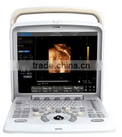 FM-580 Hospital 4D Gynecology Color Doppler CE Approved