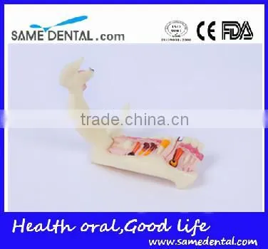 Hemi Mandible Anatomical Model Dental Eduction Assitant No. DEA-18 photo-3
