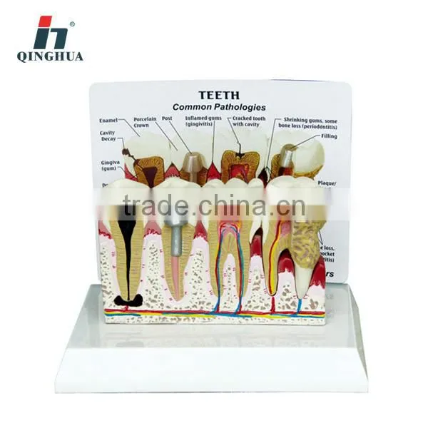 Teeth Model