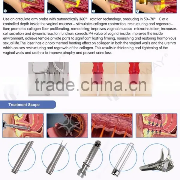 Stretch Mark Removal Medical CE Pigment Removal 30W Co2 Wrinkle Removal Fractional Machine With USA Coherent Laser photo-4
