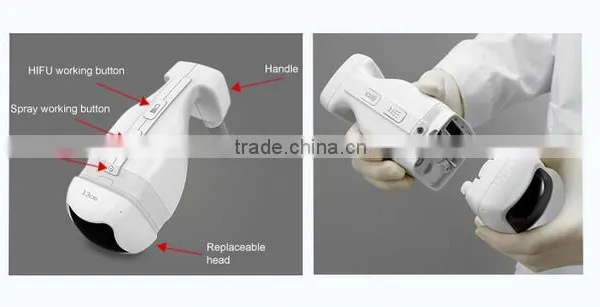 Professional and Popular Liposonix photo-3