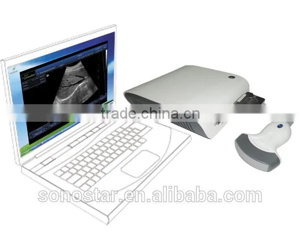 UBox-10 Ultrasound B Scanner Box photo-2