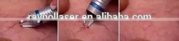 High Power Vascular RVein Removal Laser 980nm photo-2