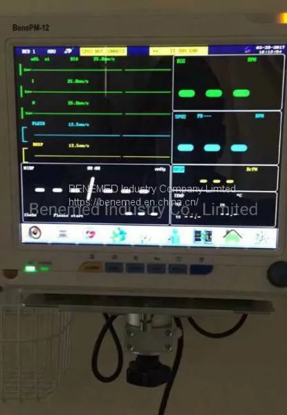 Patient Monitor With 12.1 Inch TFT Color Screen Benepm-12 photo-4