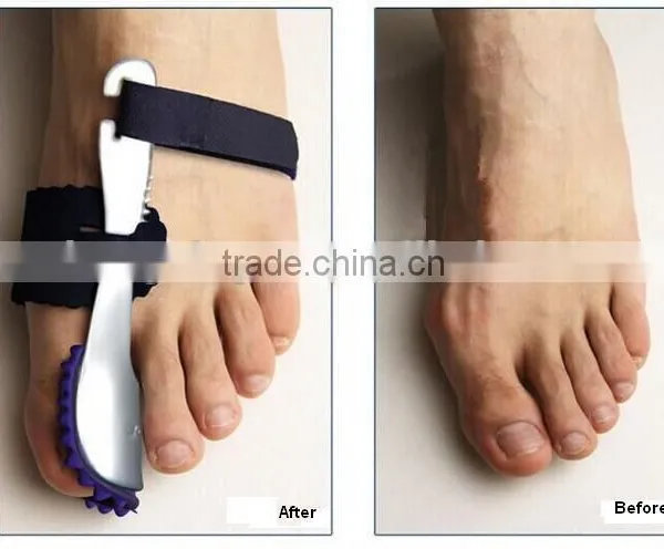 NIGHT ADJUSTABLE BUNION REGULATOR Bunion Toe Separator With EVA Material photo-2