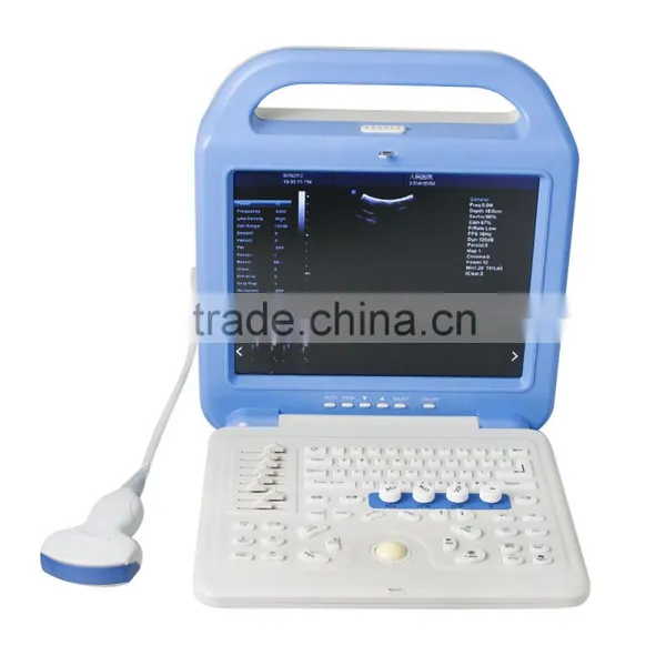 Portable Full Digital Color Doppler Ultrasound Scanner Diagnostic System 2 Probe With Convex Probe and Transvaginal Probe photo-2