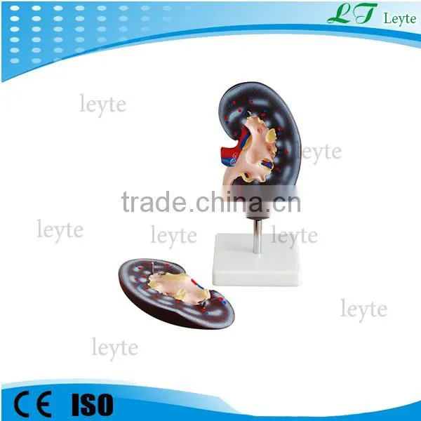 XC-310-2 2 Parts Plastic Human Kidney Model