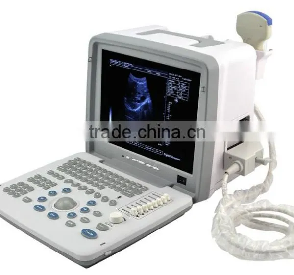 OEM Supply 12 Inch Laptop Ultrasound Scanner Ultrasonic Machine B Ultrasound Scanner for Sale photo-3