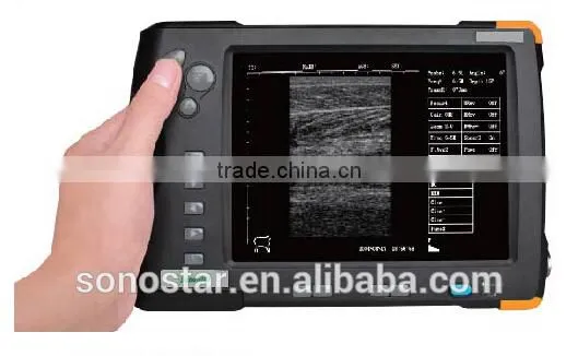 V5 Palm Ultrasound Scanner(ultrasonic,black White,Imaging Sys photo-3