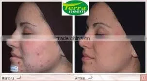 NEEM OIL PURE UNIVERSAL photo-5