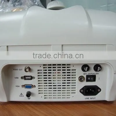 CE Approved Portable Ultrasound Scanner With 3.5Mhz Multi-frequency Convex Probe RUS-6000A photo-3