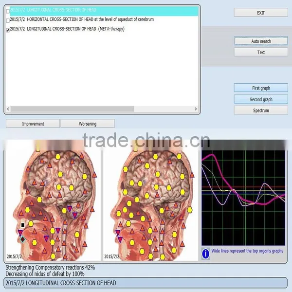 9d Nls Non Linear Diagnostic System 9d Nls Detector Tester Accuracy Above 98% Manufacturers photo-4