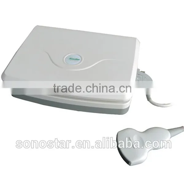 Sonostar Good Quality Handheld Portable Vet Ultrasound Scanner Pig Veterinary Ultrasound V10(SS-10V ) photo-4