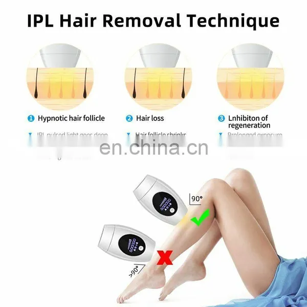 A110 Home Laser Hair Removal IPL photo-4