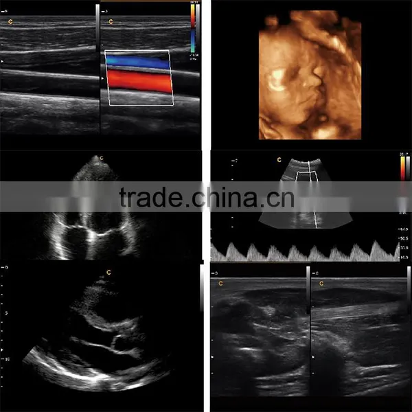 2016 Laptop/Portable 3D 4D Ultrasound Machine Color Doppler Diagnostic System photo-4