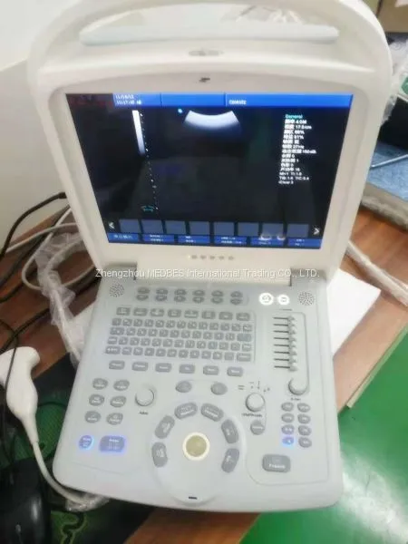 Laptop Diagnosis Color Ultrasound System photo-2