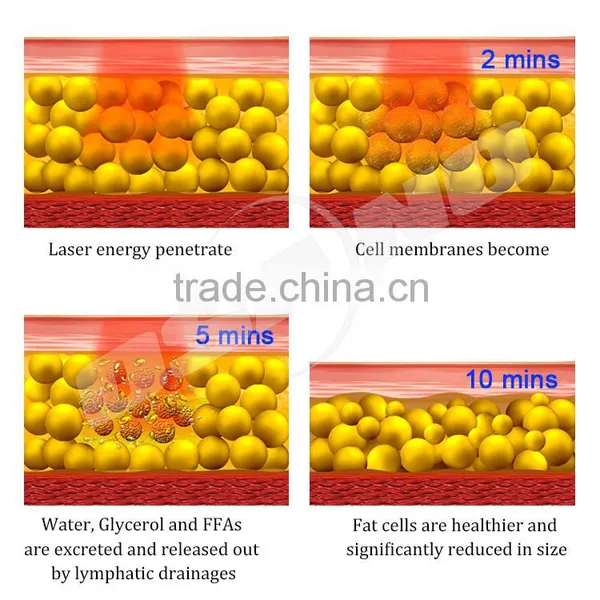 Best Lipo Laser Machine , Portable Lipolaser Slimming Machine photo-6