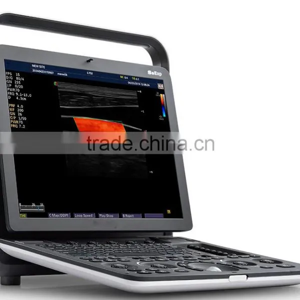 MC-DU-S8EXP Echocardiography Color Doppler Ultrasound Scanner photo-4