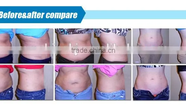 CE Approved 5 in 1 Weight Loss Cavitation rf Portable Ultrasound Device photo-6