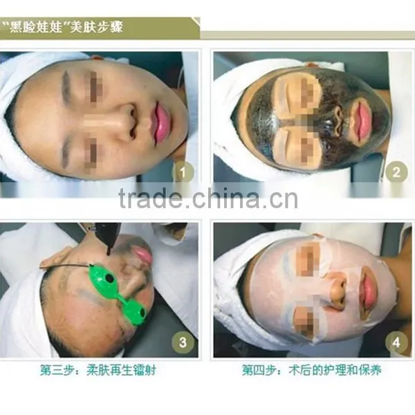 Home Laser Tattoo Removal photo-4