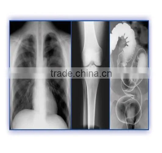 Agfa Film Agfa Dry Films Agfa X-ray Film photo-5