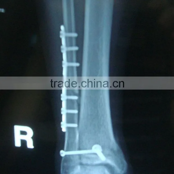China Wholesale Dental Clinic ct Film