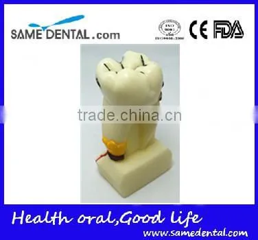.See Larger Image 4 Times Integrated Pathology Model Dental Eduction Assitant No. DEA-15 photo-2